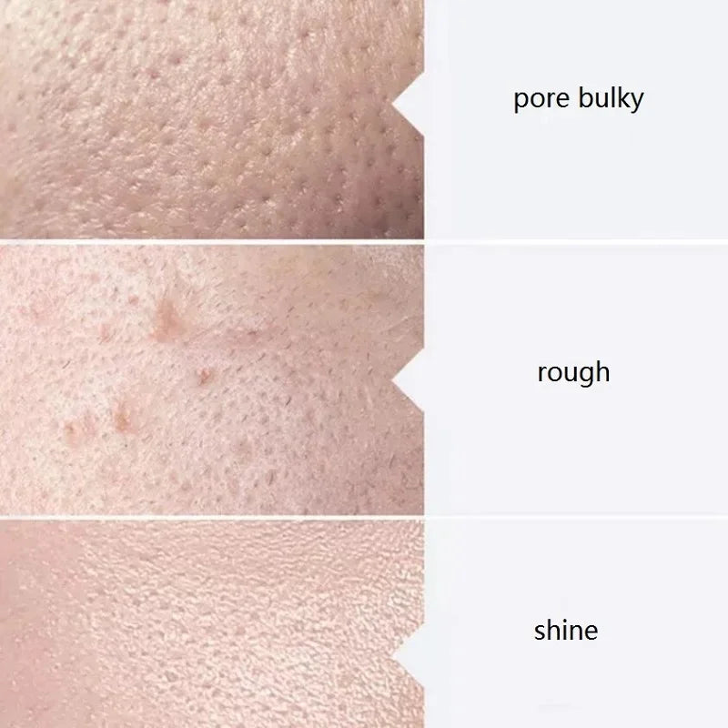 Aqua Peel Serum Kit