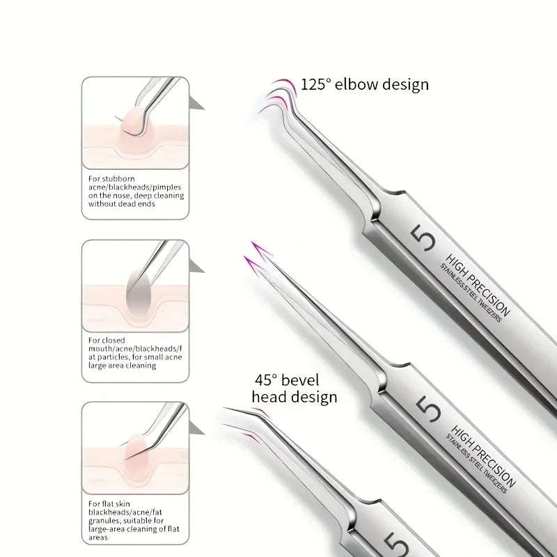Bye Bye Blackheads Remover Kit